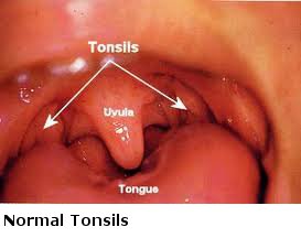 tonsils tonsil throat adenoids problems normal sinus child